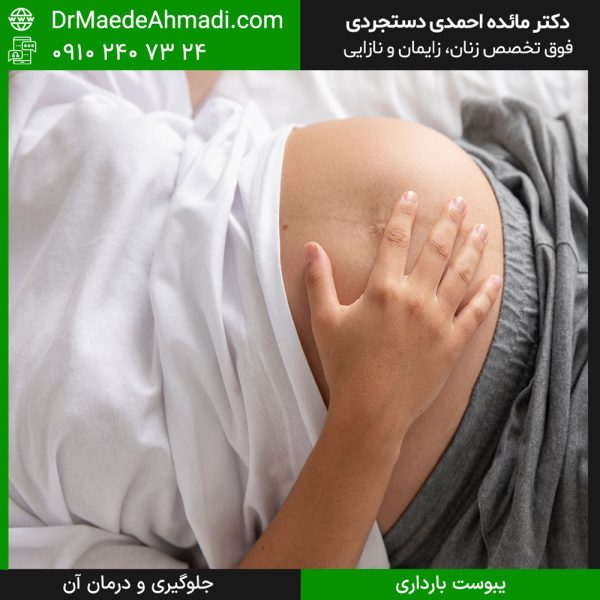 درمان یبوست بارداری