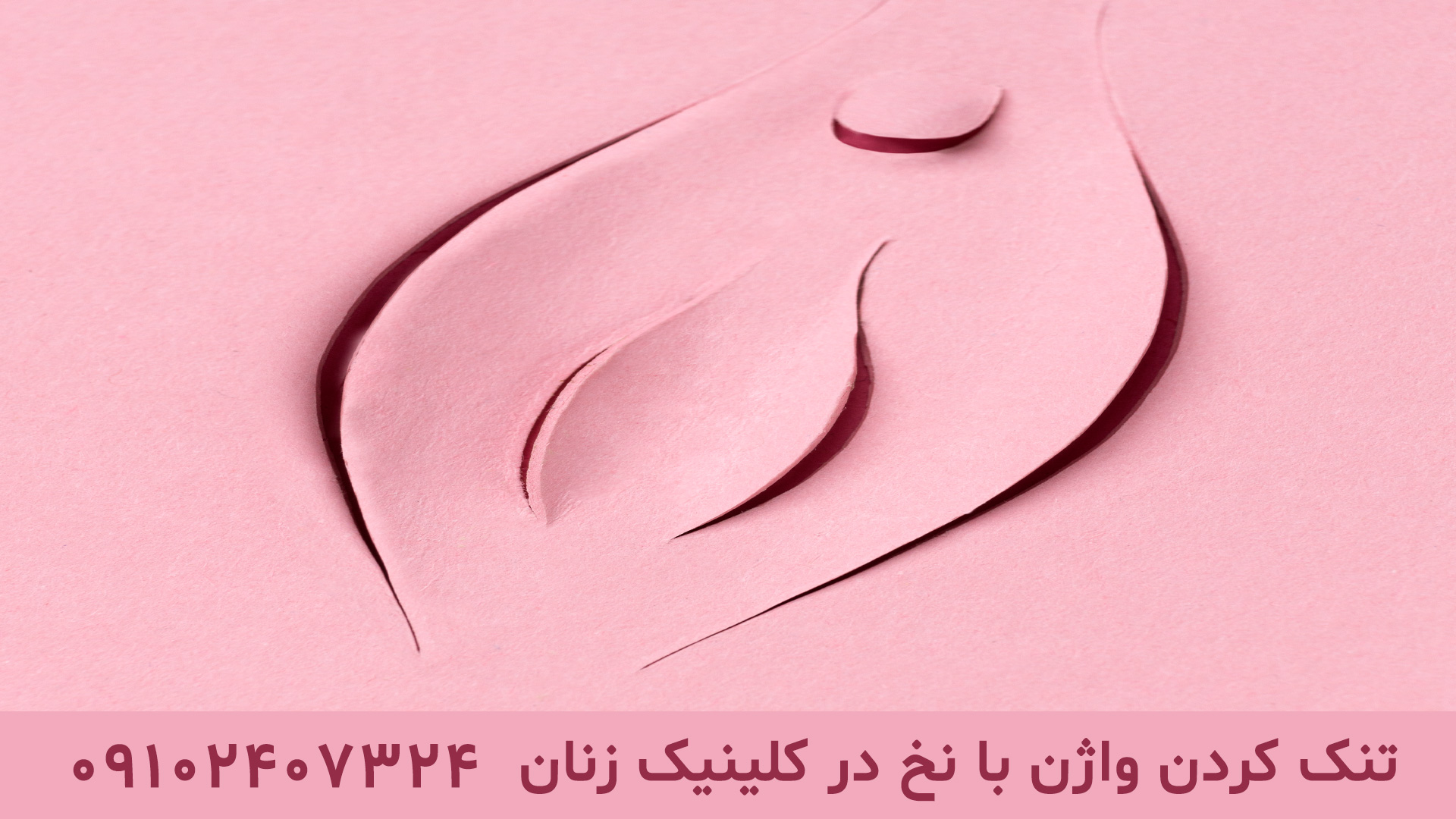 تنگ کردن واژن در کلینیک زنان تهران