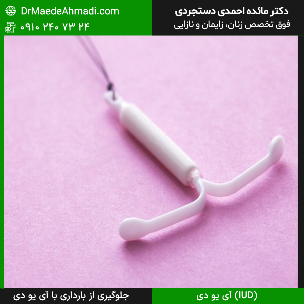آی یو دی (IUD) یا جلوگیری از بارداری با آی یو دی