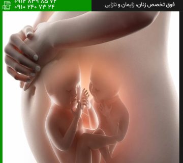 بارداری چندقلویی